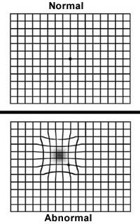 Amslenr Grid